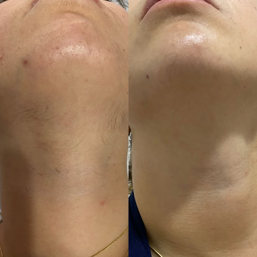 Işıltı Güzellik Salonu & Kuaför